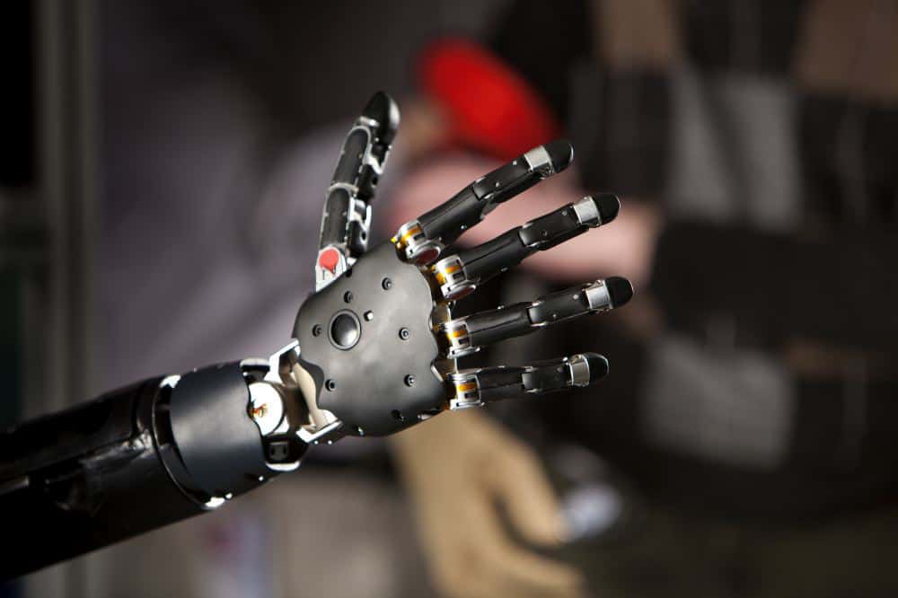 prosthetic arm image