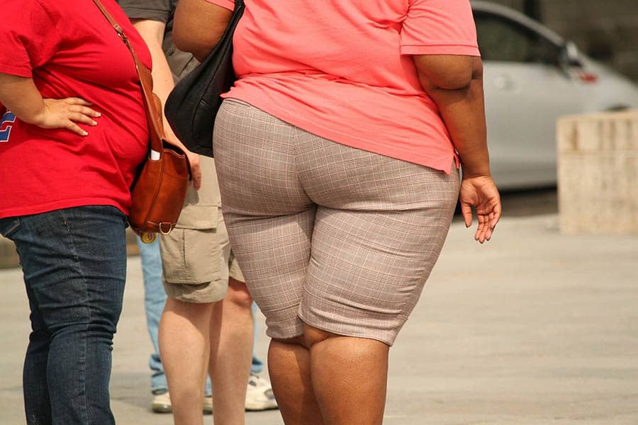 obesity image