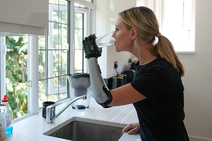 COVVI bionic hand case study image